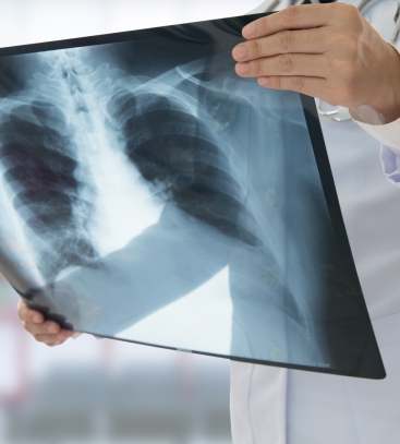 пульмонолог